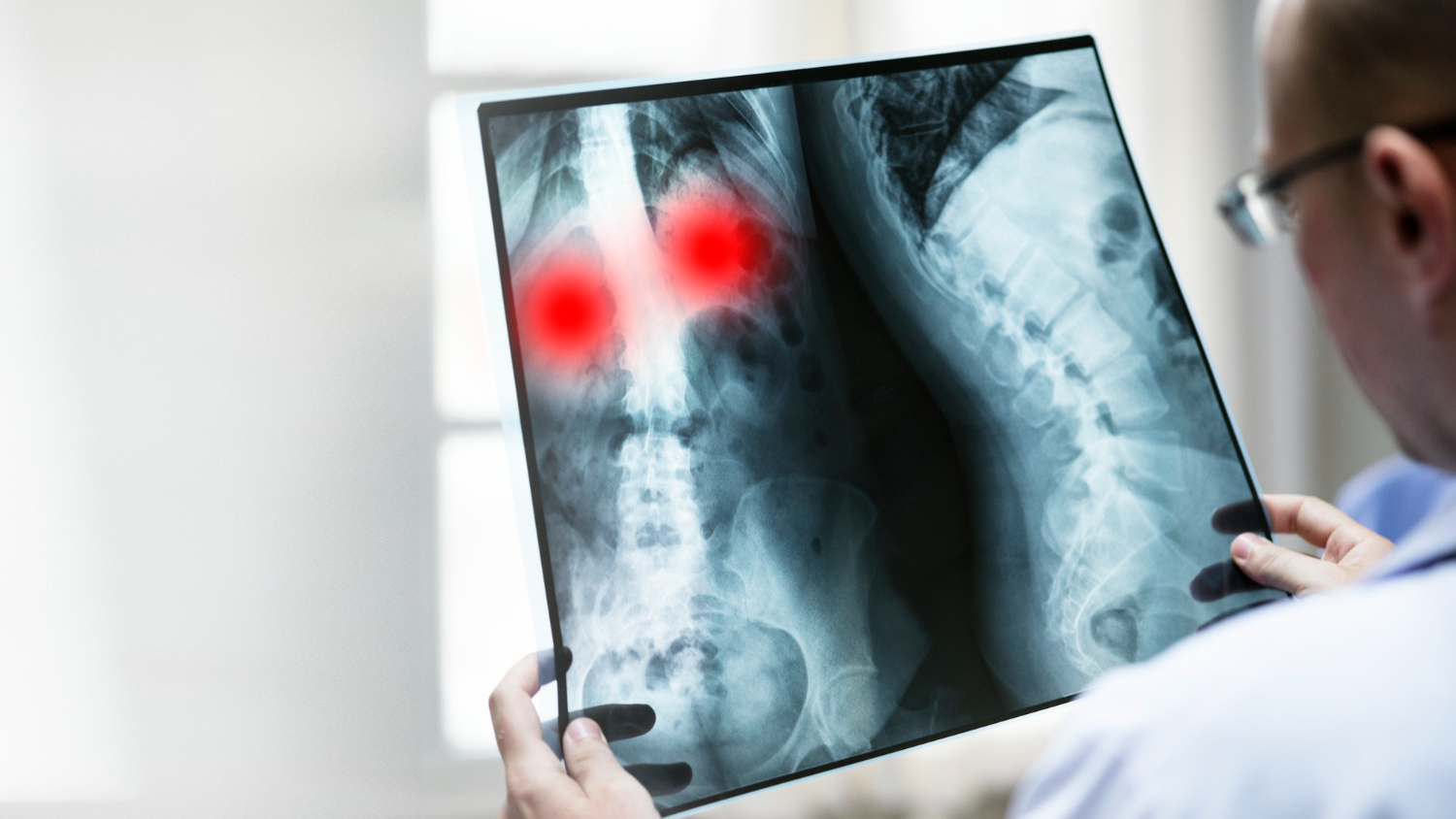 MRI & X-Ray in Metairie